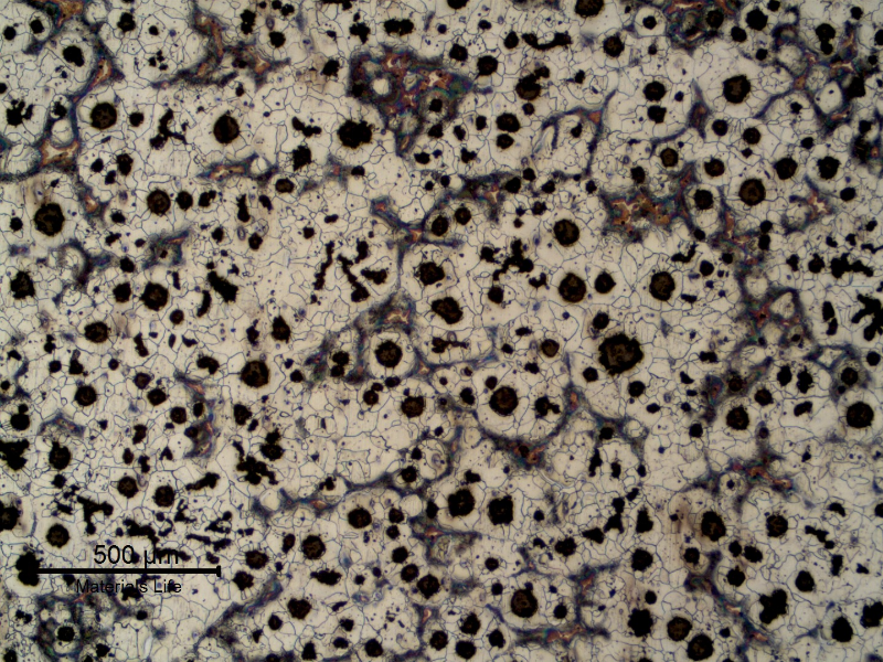 The 1" flat casting product presents a ferritic perlitic matrix and graphite nodules.