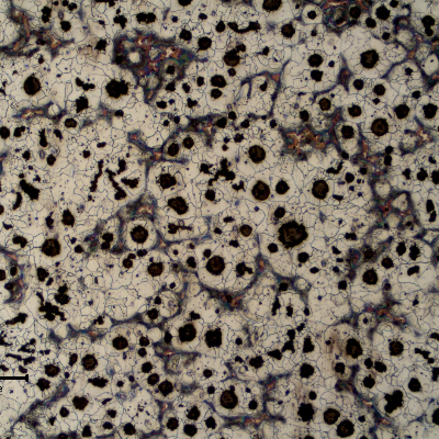 The 1" flat casting product presents a ferritic perlitic matrix and graphite nodules.