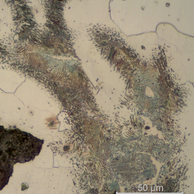 Nodular cast iron.  Ferritic perlitic matrix. White regions in the pearlite colonies are free carbides.