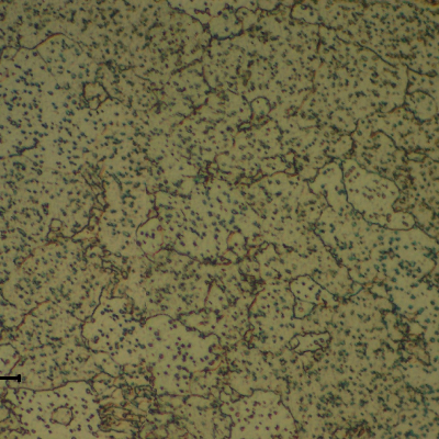 Micrographic detail of a longitudinal section of the bolt close to the fracture, presenting an overtempered structure.