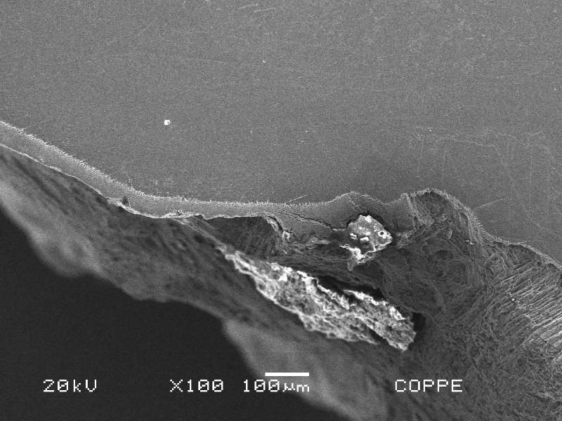 Region of the localized thinning at the weld metal, in a metallographic section, as polished. In the base metal the hydride layer is continuous and no thinning is evident (left side of the figure) and in the weld metal it is detached and cracked (right side of the figure).