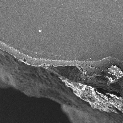 Region of the localized thinning at the weld metal, in a metallographic section, as polished.  In the base metal the hydride layer is continuous and no thinning is evident (left side of the figure) and in the weld metal it is detached and cracked (right side of the figure).