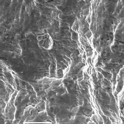 Fracture surface micromechanism by striation, evidence of FATIGUE.