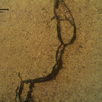 Cold cracking of the fillet weld adopted to attach a flat support into a vessel shell using an unsuitable welding procedure, with a low preheating and no PWHT. Cracks propagated in the weld metal.
