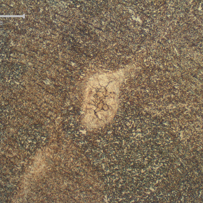 Detail of a region of entrapped carbon from the arc gouging, in the weld metal.