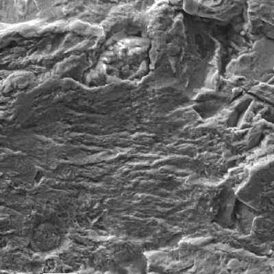 Detail of the fatigue fracture propagation, with striation micromechanism.