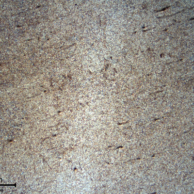 Micrography of a longitudinal section of the mooring chain at the flash welded region. The banded structure is deformed by the upset, close to the weld metal that is ferritic-bainitic.