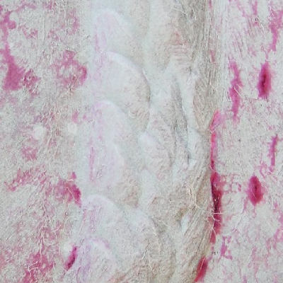 Visual aspect of the repair welded plate surface, cracked during welding.  Several cracks paralell to the welded regions, revealed by dye check, appear adjacent to the repair beads.  The width of the repair is 15 mm.