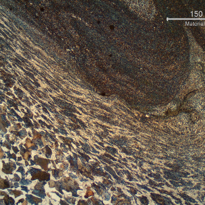 The non hardened surface of the SPUR RACK tooth presents a strong plastic deformation at the metal to metal contact region. There are also evidences of heat transformation due to the heat generated in the sliding.