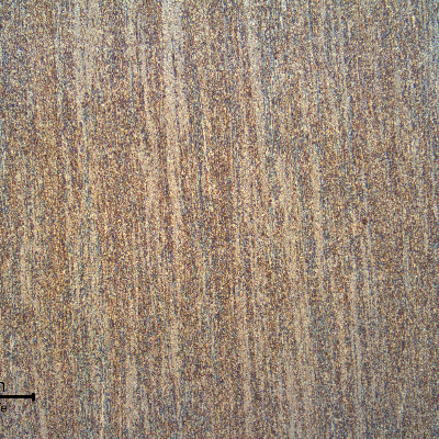The plate longitudinal section presents a granular refined structure. Biphasic.