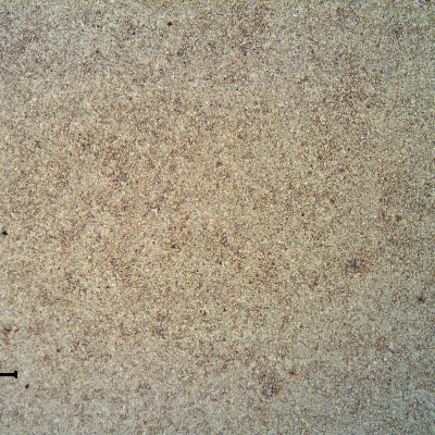 Longitudinal section of the fitting in the center of the thickness (2"). Refined ferritic structure.