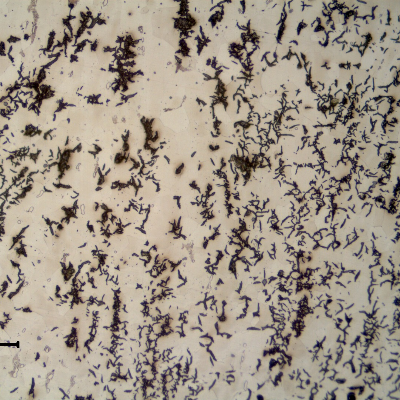 Micrography of the longitudinal section of the pipe, close to the external surface. Graphite in flakes and predominantly ferritic matrix .