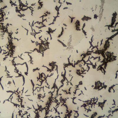 Micrography of the longitudinal section of the pipe, close to the external surface. Graphite in flakes and predominantly ferritic matrix .