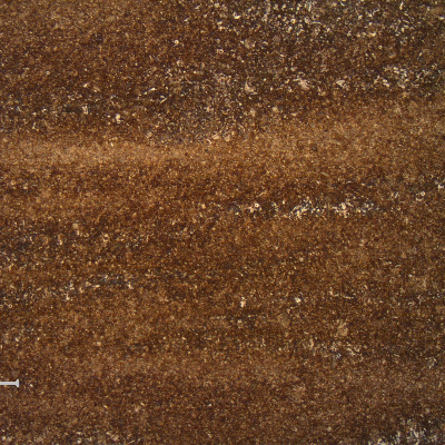 The micrography in the longitudinal section in the middle of the thickness shows a light banding. Quenched and tempered structure.