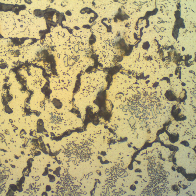 Micrography of the transverse section of the TUBE REMOVED FROM SERVICE,close to the external surface, showing the austenitic structure with coalesced carbides and secondary precipitation.