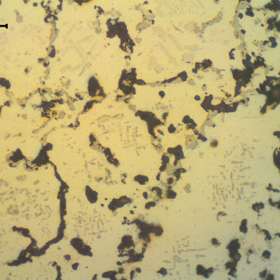 The micrography in the as polished condition of the TUBE REMOVED FROM SERVICE shows that after one year operating in high temperature the material  opens voids in the center of the thickness. Even the secondary carbide is coalesced.