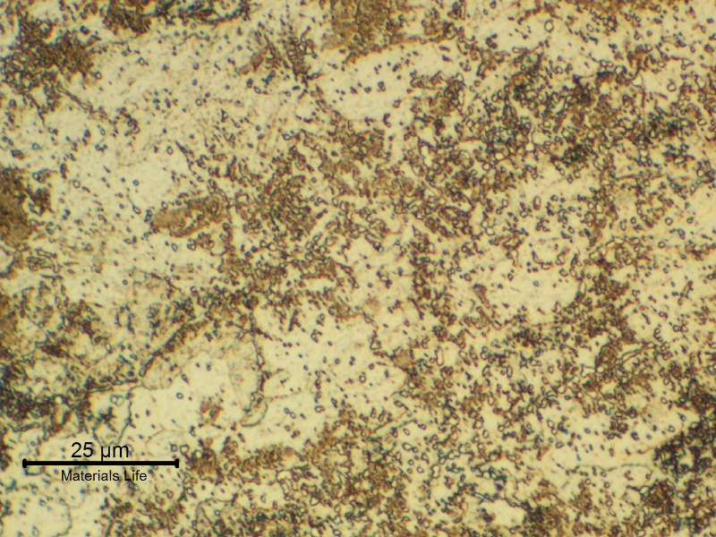 The micrography of the 13Cr SS in the transverse section, at the collapsed region, shows a ferritic matrix structure (overtempered) with the previous austenite grain boundaries decorated by phases (carbides and probably martensite islands), indicating that the material was exposed to a high tempering temperature that created a partial austenitizing condition. It explains the material low toughness and lower strenght (than required).