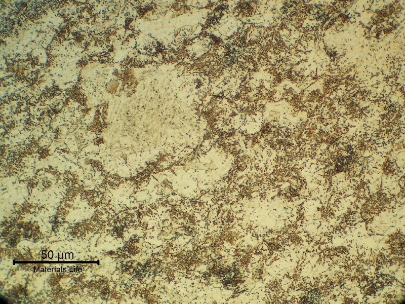 13Cr SS transverse section micrography, at the collapsed region, showing a ferritic matrix structure (overtempered) with the previous austenite grain boundaries decorated by phases (carbides and probably martensite islands), indicating that the material was exposed to a high tempering temperature that created a partial austenitizing condition. It explains the material low toughness and lower strenght (than required).