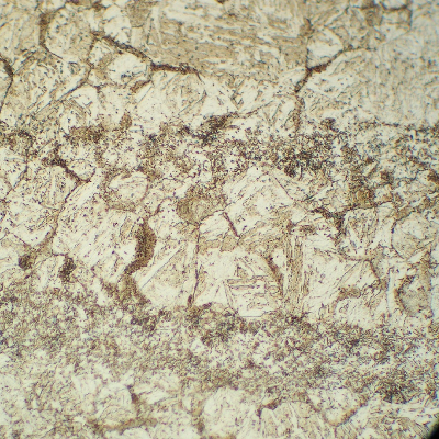 13Cr SS in the longitudinal section, at the collapsed region. Non uniform structure (ferritic matrix and decorated prior austenite grain boundaries) that evidences an usuitable heat treatment during fabrication, and explains the material low strenght.