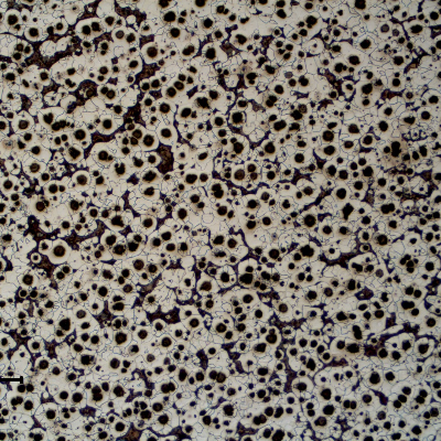 Micrography of CAP C, showing graphite in nodules and ferritic-perlitic matrix.