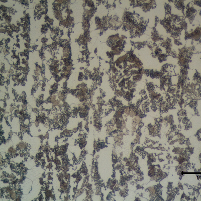 Detail of Pin B microstructure. Ferritic-bainitic.