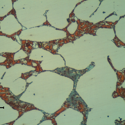 Micrographic detail of the flange base metal presenting a coarse duplex ferritic austenitc structure. Detrimental phases associated to the ferritic structure.