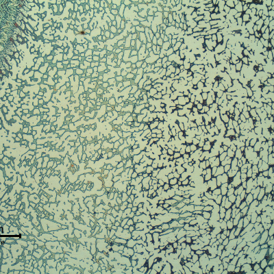 Micrography of the flange heat affected zone.  In the right the flange base metal, with coarse structure and detrimental phases associated to the ferrite; and in the left the weld metal, with Widmanstatten morphology of the structure.