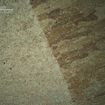 Micrography of the fusion line of the second pass (not reheated).  The HAZ is bainitic and the weld metal presents columnar grains (of the previous austenite).