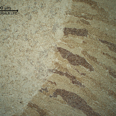 Fusion line of the first pass (reheated in high temperature).  The HAZ is bainitic and the weld metal microstructure is predominantly formed by acicular ferrite.