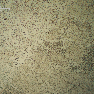 Micrographic detail of the fusion line of the first pass (reheated in high temperature). The HAZ is bainitic and the weld metal microstructure is predominantly formed by acicular ferrite.