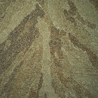 Center of the weld in the second pass. Columnar grains of the previous austenite.