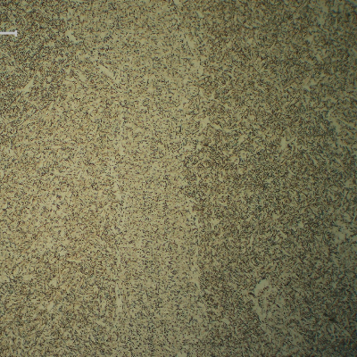 Micrographic detail of the center of the weld in the second pass (not reheated). Fine structure mainly formed by acicular ferrite.
