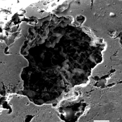 Detail of the micrographic aspect of the pitting corrosion at the knife surface.