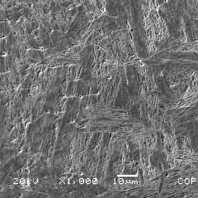 Micrographic detail of the insert casting fusion line, presenting the tempered martensitic structure for the HAZ (right side of the figure) and the delta ferrite interdendritic islands in the weld metal (left side of the figure).