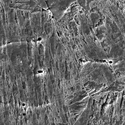 Micrographic detail of the inserted casting at the fusion line, presenting the tempered martensitic structure and the interdendritic delta ferrite islands.
