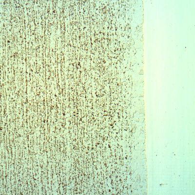 Micrography of a longitudinal section of the pipe showing that the carbon steel pipe is slightly banded and there is a decarburized layer at the solid solution welded interface. The stainless steel structure (in the right side of the figure) is not revealed using the Nital etch.