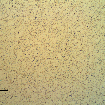 Transverse section of the ring presenting a fully ferritic structure, that presents a hardness level a little higher probably due to a cold forming effect.