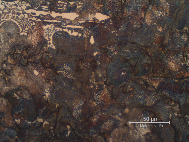 Micrographic detail of the structure in the center of the shaft thickness. Perlitic matrix with graphite in flakes, and ledeburite islands.