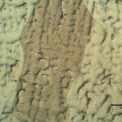 Micrographic detail of the weld metal in the center.