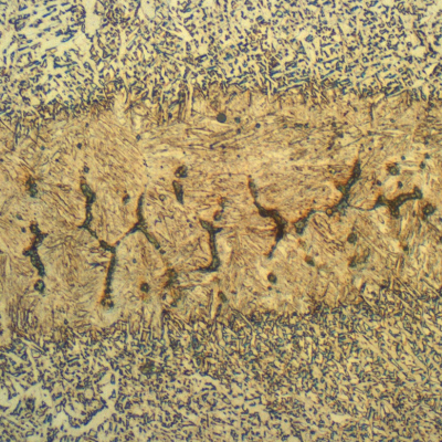 Micrography of the weld metal presenting a martensitic island with microcracks, due to a localized increase in the manganese and silicon content, probably because an active flux was adopted in a condition where a high cleanning action was not required. A high flux-to-wire ratio (>1) could also be an issue.