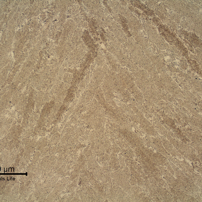 Micrography of the weld metal in the center of the fillet.  Typical ferritic structure and typical low carbon chemistry.