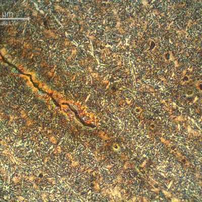 Micrographic detail of the weld metal in a cracked region.