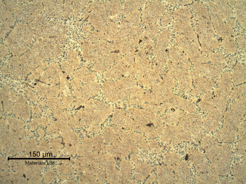 Micrography of the cast rim, base metal, showing the dendrites of alpha aluminum and interdendritic eutectic Si/alpha, silicon particles in a coalesced condition that suggests a solution annealed treatment.  After etching it is possible to identify a transgranular precipitation (aging) and a dark FeSiAl phase (neddles).