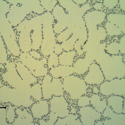 Micrography of the cast rim, base metal, in the as polished condition, showing the dendrites of alpha aluminum and interdendritic eutectic Si/alpha, silicon particles in a coalesced condition that sugegsts a solution annealed treatment.