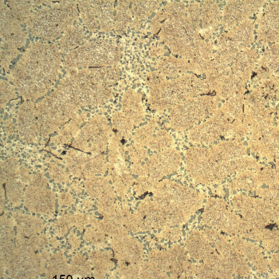 Micrography of the cast rim, base metal, showing the dendrites of alpha aluminum and interdendritic eutectic Si/alpha, silicon particles in a coalesced condition that suggests a solution annealed treatment.  After etching it is possible to identify a transgranular precipitation (aging) and a dark FeSiAl phase (neddles).