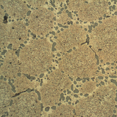 Micrographic detail of the cast rim, base metal, showing the dendrites of alpha aluminum and interdendritic eutectic Si/alpha, silicon particles in a coalesced condition that suggests a solution annealed treatment.  After etching it is possible to identify a transgranular precipitation (aging) and a dark FeSiAl phase (neddles).