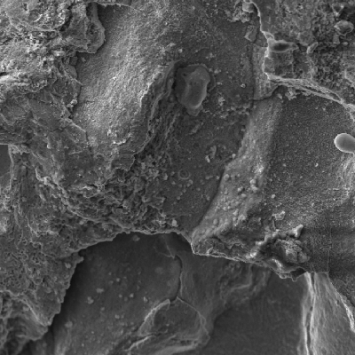 Intergranular morphology of the fracture in a scanning electron microscopy image.