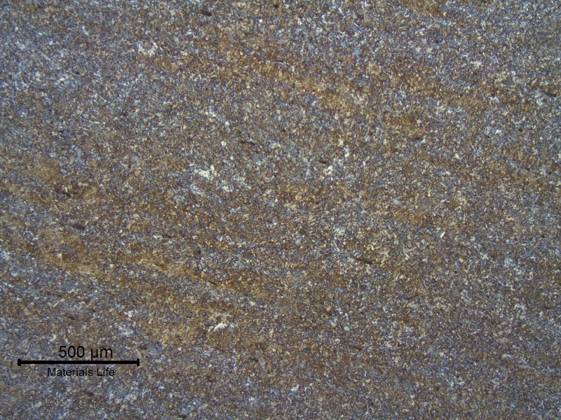 Micrography of the AISI 4130 forging, 5/8" thickness, close to the welded region, in the longitudinal section.