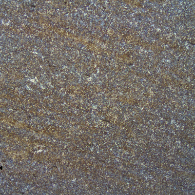 Micrography of the AISI 4130 forging, 5/8" thickness, close to the welded region, in the longitudinal section.