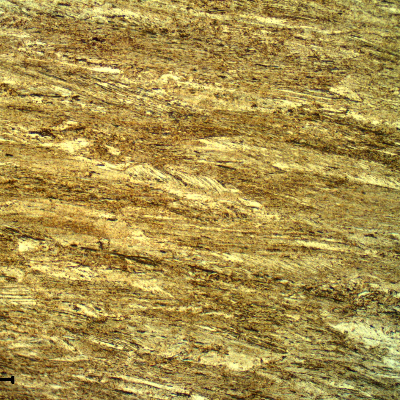 The longitudinal section of the spring wire shows a strain hardened martensitic structure, aged to high strength (602 HV 0.3kg). Previous austenite grains are elongated.